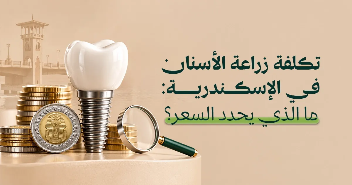 تكلفة زراعة الأسنان في الإٍسكندرية